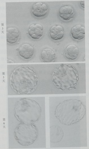 图2-12  体外培养了3、5、6天的胚胎