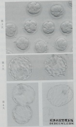 图2-12  体外培养了3、5、6天的胚胎