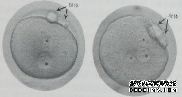 图2-11   正常受精卵