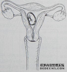 图1-8  胚胎着床和胎盘形成